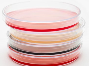 Scientists use agar plates to show the formation of lactic acid producing bacteria.