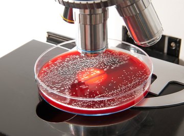 What Is Arrangement in Microbiology