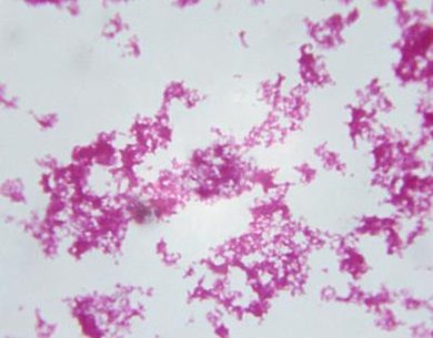 Bacteria Bubonic Plague Images : Pin on this an that''' and everthing' - Plague is a serious bacterial infection that's transmitted primarily by fleas.