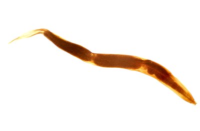 How to Cure Pinworms Naturally (with Pictures) | eHow