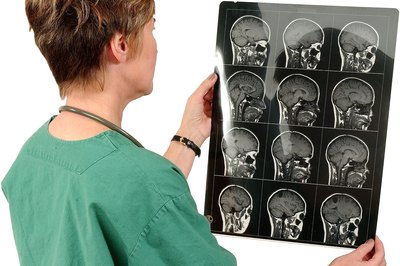 Zedcor Wholly Owned/PhotoObjects.net/Getty Images Neurolgists treat the brain and nervous system.
