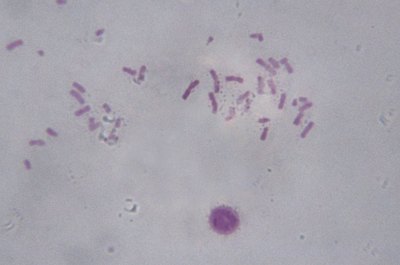 Duncan Smith/Photodisc/Getty Images Cytogenetic technologists detect the genetic markers of Down syndrome and other conditions.