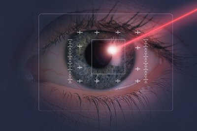 Comstock/Comstock/Getty Images A tax deduction could offset part of the cost of corrective laser eye surgery.