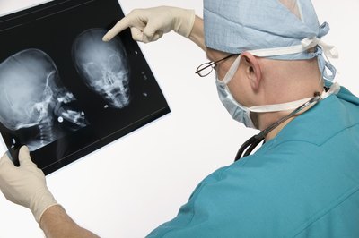 Jupiterimages/liquidlibrary/Getty Images Neurosurgeons read medical images to diagnose.