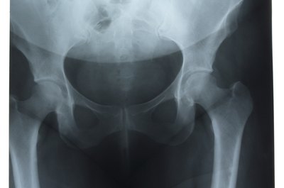 Hemera Technologies/AbleStock.com/Getty Images Hip external rotation exercises help to keep the joint stable.