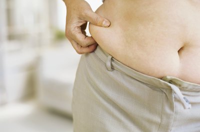 Stockbyte/Stockbyte/Getty Images In most cases, your skin can handle your weight loss goals.