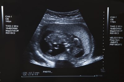 BananaStock/BananaStock/Getty Images Ultrasounds utilize high-frequency sound waves to create images of what’s inside the body.