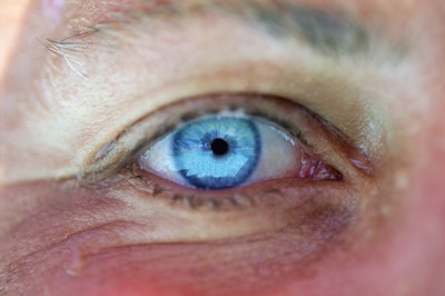 Jupiterimages/Comstock/Getty Images Bilberry is used in alternative medicine to treat eye conditions but lacks scientific proof of its efficacy.