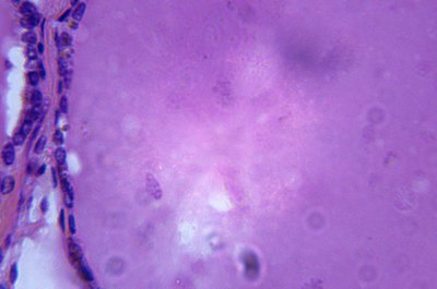 Duncan Smith/Stockbyte/Getty Images This is a microscopic image of the thyroid gland.