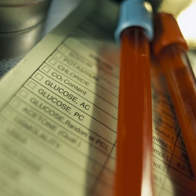 Hemera Technologies/Photos.com/Getty Images Hematologist tools are used to collect and analyze blood.