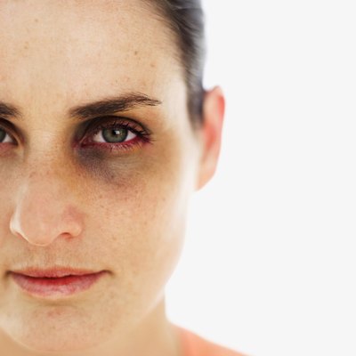 Stockbyte/Stockbyte/Getty Images Domestic violence could include physical, sexual or emotional abuse.