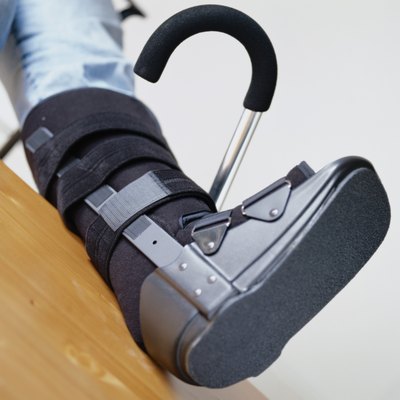 Photodisc/Photodisc/Getty Images A broken foot makes climbing stairs a challenge.