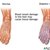 Reasons for Poor Circulation in the Feet