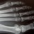 What Are the Functions of X-Rays?