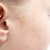 How to Dry Up the Fluid of a Middle Ear Infection