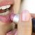 Signs & Symptoms of Oral Herpes on the Tongue