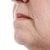 Exercises for Flab Under the Chin