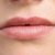 How Do You Get Staph Around the Lips?