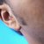 How Long Will Tinnitus Last?