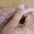How to Relieve Nerve Pain in a Little Finger