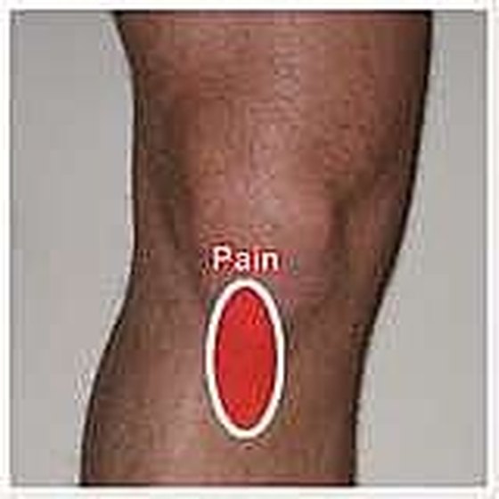 How Does The Patellar Tendon Heal After Acl Surgery