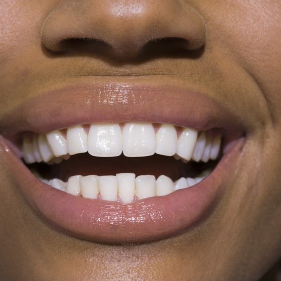 Hydrogen peroxide natural teeth whitening