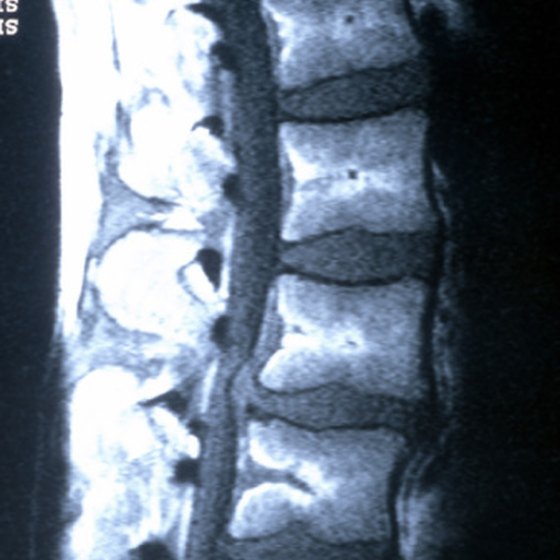 parts of spine