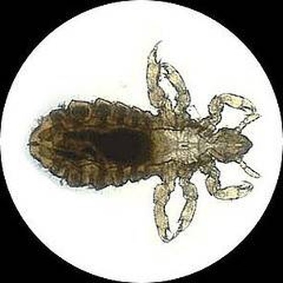 what-do-body-lice-bites-look-like-healthy-living