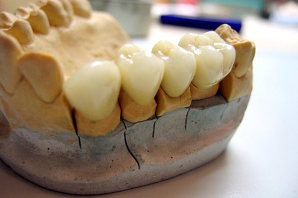 Necesitarás tres moldes diferentes para hacer un conjunto de dientes falsos.