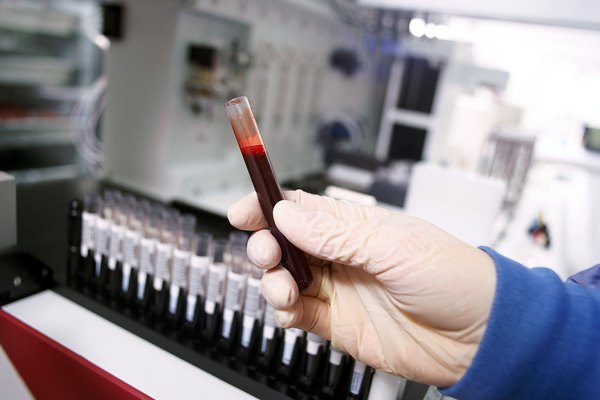 A gloved hand holding a vile of blood in a laboratory