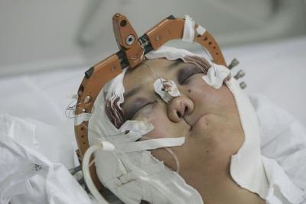 China Photos/Getty Images News/Getty Images La cirugía reconstructiva y estética puede ayudar a corregir deformidades, haciendo posible la vida normal..