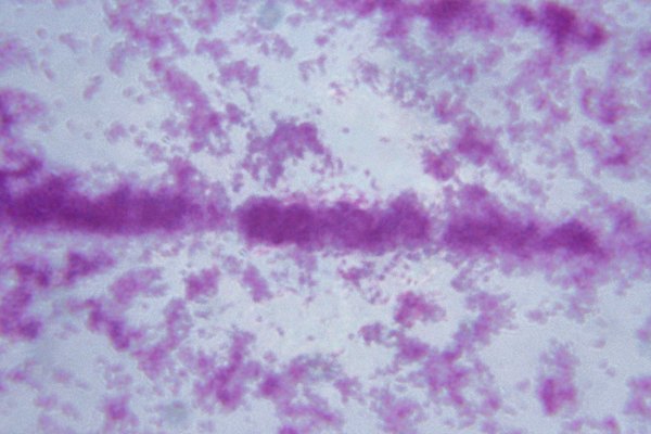 Las células bacterianas requieren del proceso de la tinción para ser identificadas.