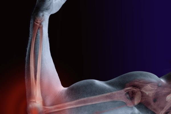 El húmero es el hueso de la parte superior del brazo.
