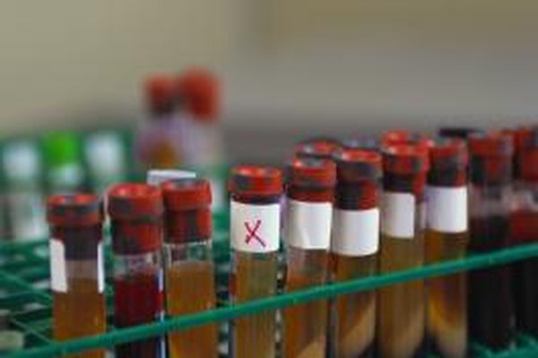 Que hace un tecnico de laboratorio salud Que hace un tecnico de laboratorio salud