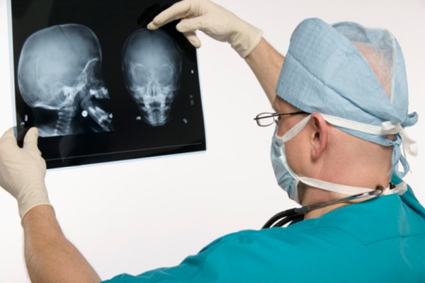 Los neurocirujanos examinan una radiografía para determinar el diagnóstico correcto de los problemas neurológicos.