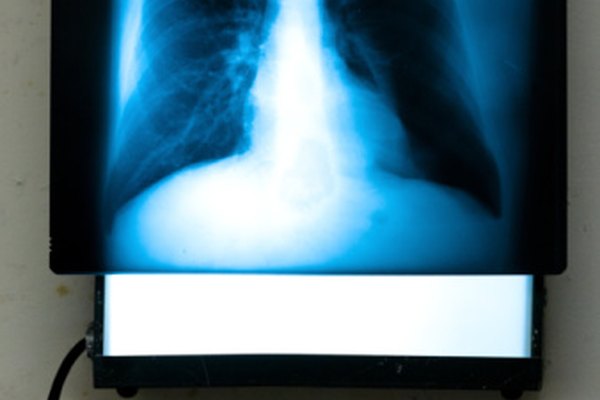 Los programas de estudio de radiología están creciendo con mucha rapidez.