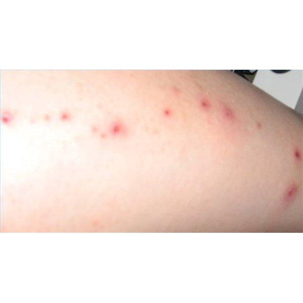 how-to-diagnose-a-skin-rash-healthfully