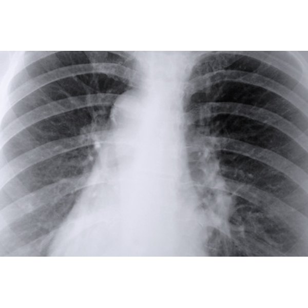 How Many Types Of Lung Infections Are There