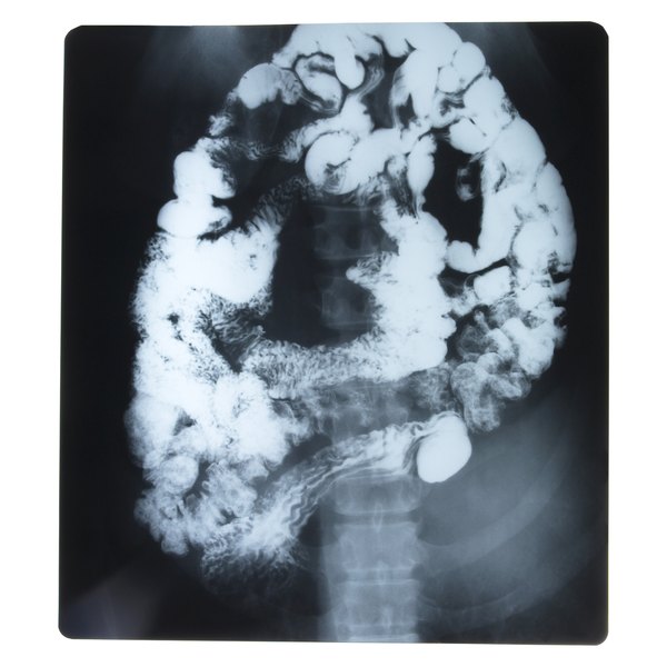 An Associate vs. Bachelor's in Radiology | Synonym