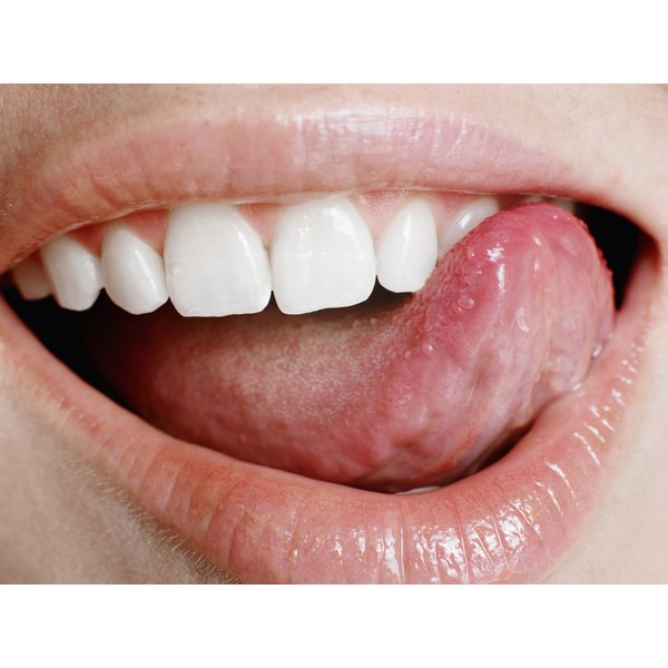 How To Get Rid Of Tongue Sores Healthfully