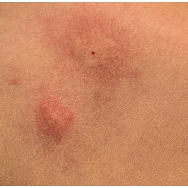 facial itching and redness My sex pictures