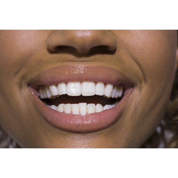 do-it-yourself-mouthpiece-molding-for-teeth-whitening-our-everyday-life