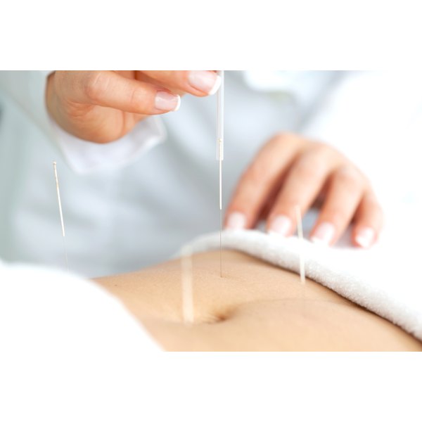 Acupressure and Acupuncture for GERD | Healthfully