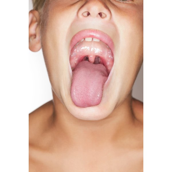 raised-tender-bumps-on-the-tongue-healthfully