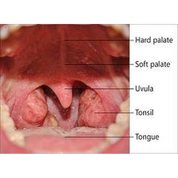 Can Genital Herpes Cause Strep Throat