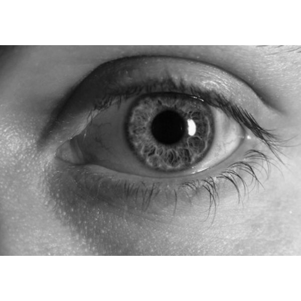 What Are the Treatments for a Bruised Swollen Eye? | Healthfully