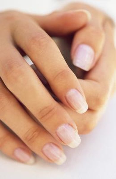 Striations on Fingernails &amp; Nutrition - Woman