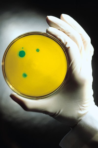 Wearing gloves when handling agar plates prevents bacteria from your hands from contaminating your sample.