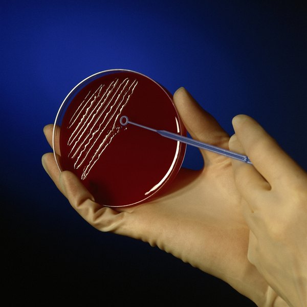 The first inoculation should cover about one-third of the agar plate.