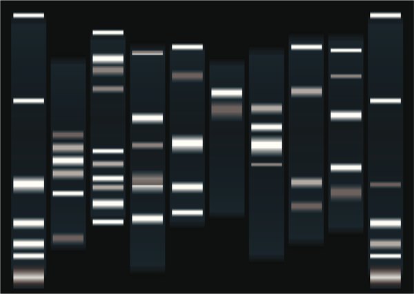 Each band in the visualized gel represents a group of DNA fragments of the same size.